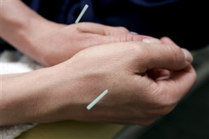 Vrouw met beknelde zenuw krijgt acupunctuursessie